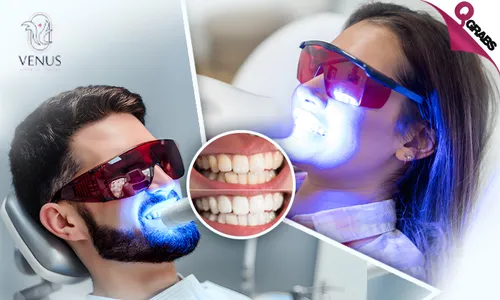 Brighten your Smile with Zoom Teeth Whitening!